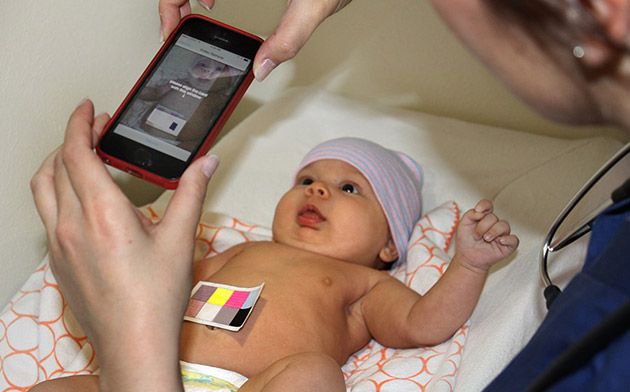 Un’app sperimentale permetterà di rilevare l’ittero nei neonati da una foto