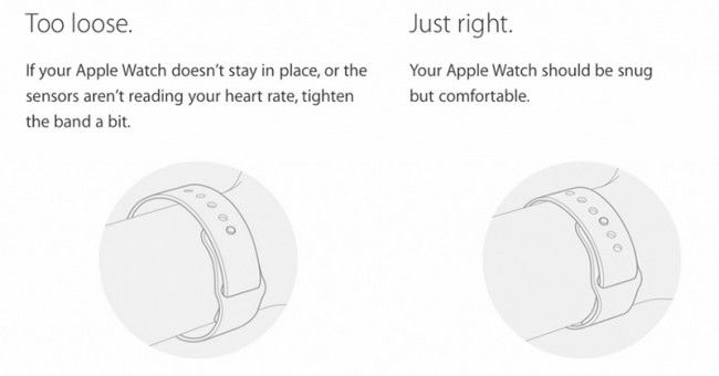 apple-watch-irritations-bracelets