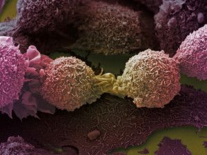 tumori biochip
