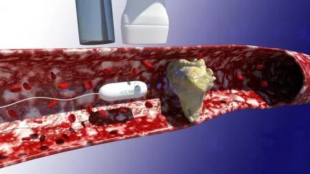 MicroVast