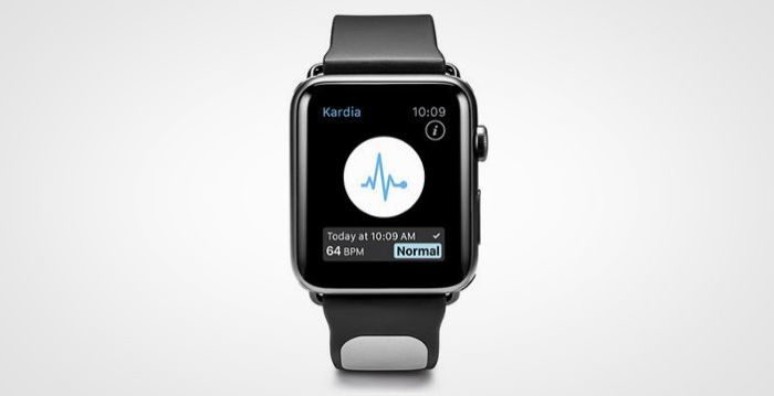 kardiaband_apple-watch