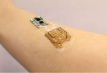 Cerotti smart progettati per monitorare e personalizzare il trattamento delle ferite