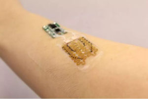 Cerotti smart progettati per monitorare e personalizzare il trattamento delle ferite
