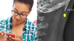 smartphone corna sul cranio