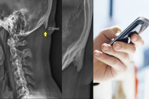 smartphone corna cranio giovani