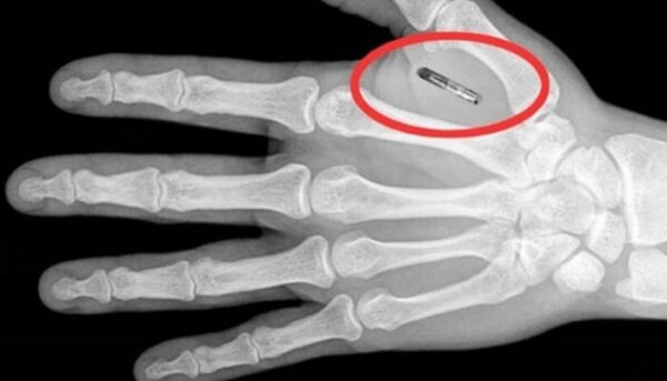 microchip