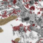 nuovo coronavirus