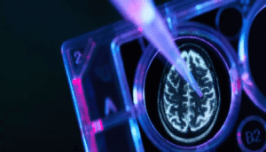 declino cognitivo