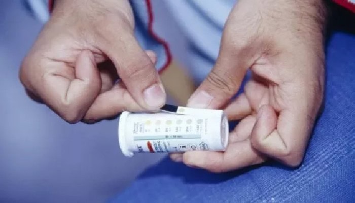 Diabete mellito: ecco un nuovo indicatore per rilevare la patologia