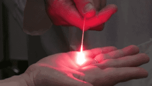 terapia fotodinamica