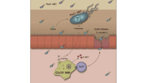 Morbo di Crohn