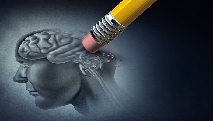 Alzheimer, nuovo farmaco in test che previene la formazione di placche amiloidi