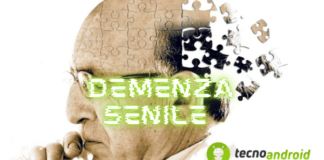 Demenza senile