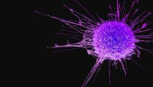 covid-19-cancro-remissione-coronavirus