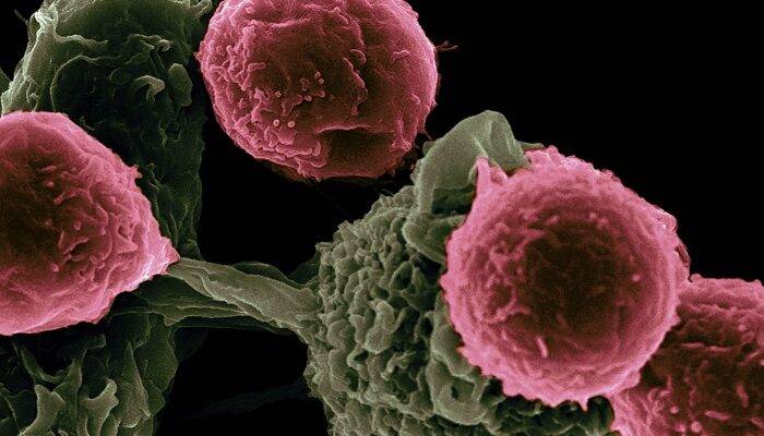 covid-19-coronavirus-contagiato-cancro-sconfitto