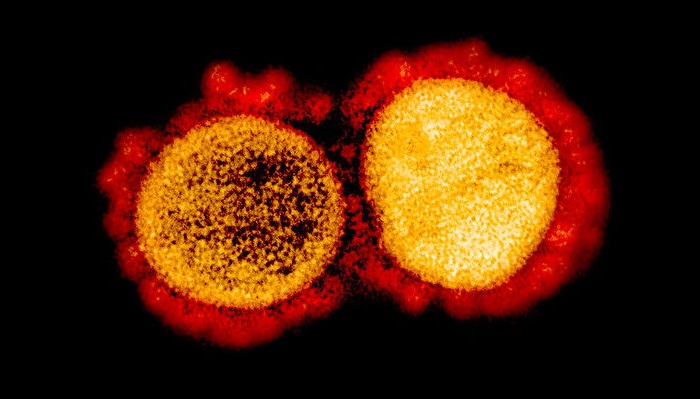 covid-19-varianti-coronavirus-triple-mutazioni