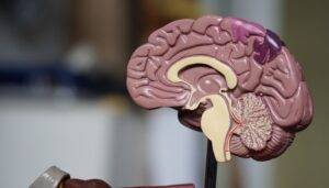 alzheimer-malattia-quattro-tipologie