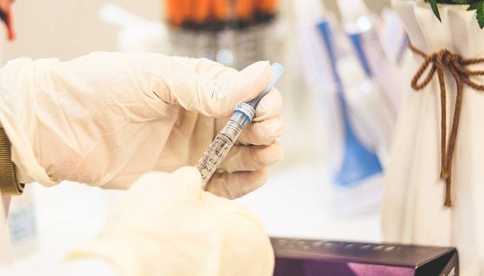 astrazeneca-effetti-collaterali-covid-19