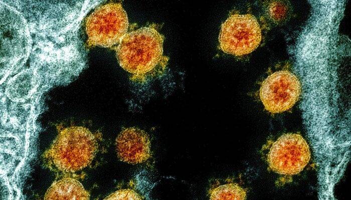 variante-lambda-ceppo-virus