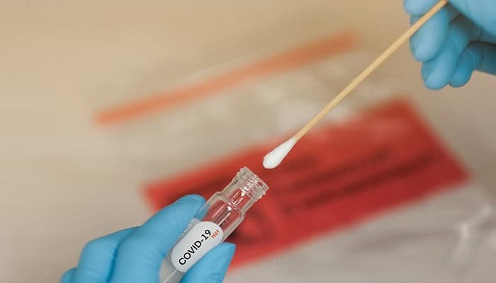 Test Covid, Amazon li venderà online a prezzo inferiore rispetto al mercato