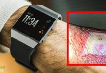 Fitbit: orologi richiamati dal mercato, possono provocare ustioni