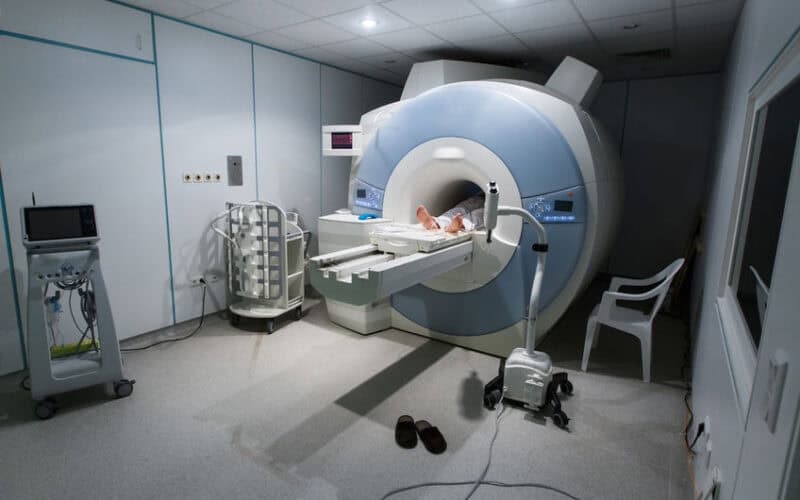 Alzheimer intelligenza artificiale
