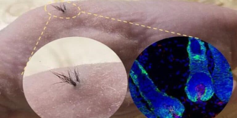 Coltivati con successo in laboratorio dei follicoli piliferi