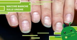 Unghie, scoperta la verità nascosta dietro le macchioline bianche