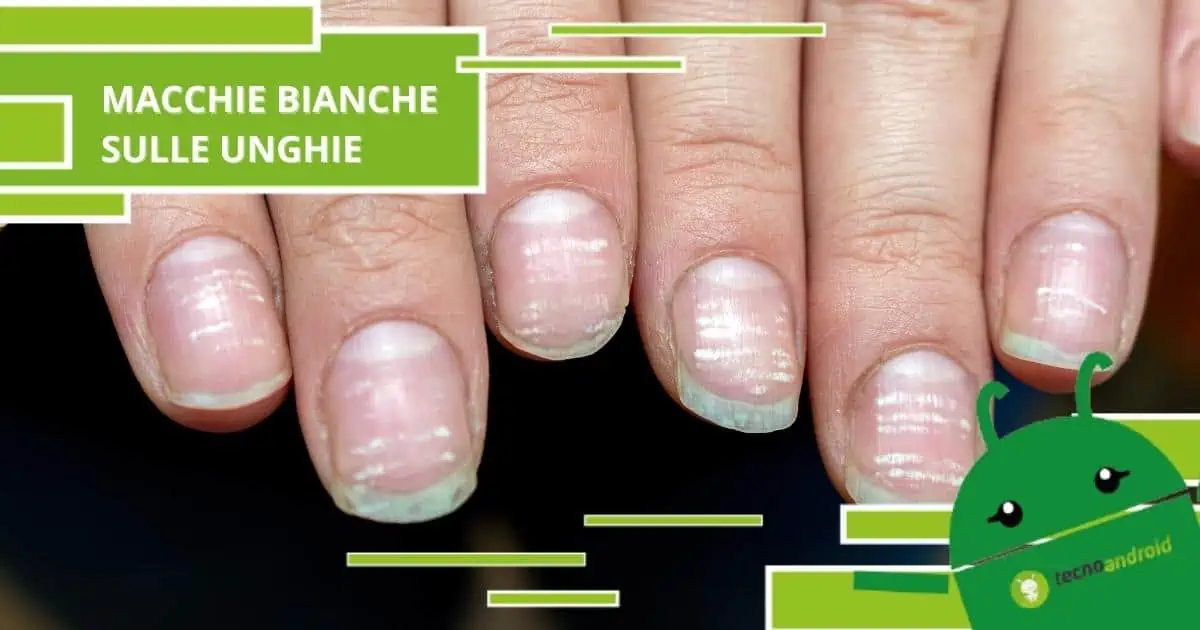 Unghie, scoperta la verità nascosta dietro le macchioline bianche