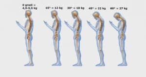 tech neck