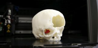 chirurgia grazie all’uso della stampa 3D