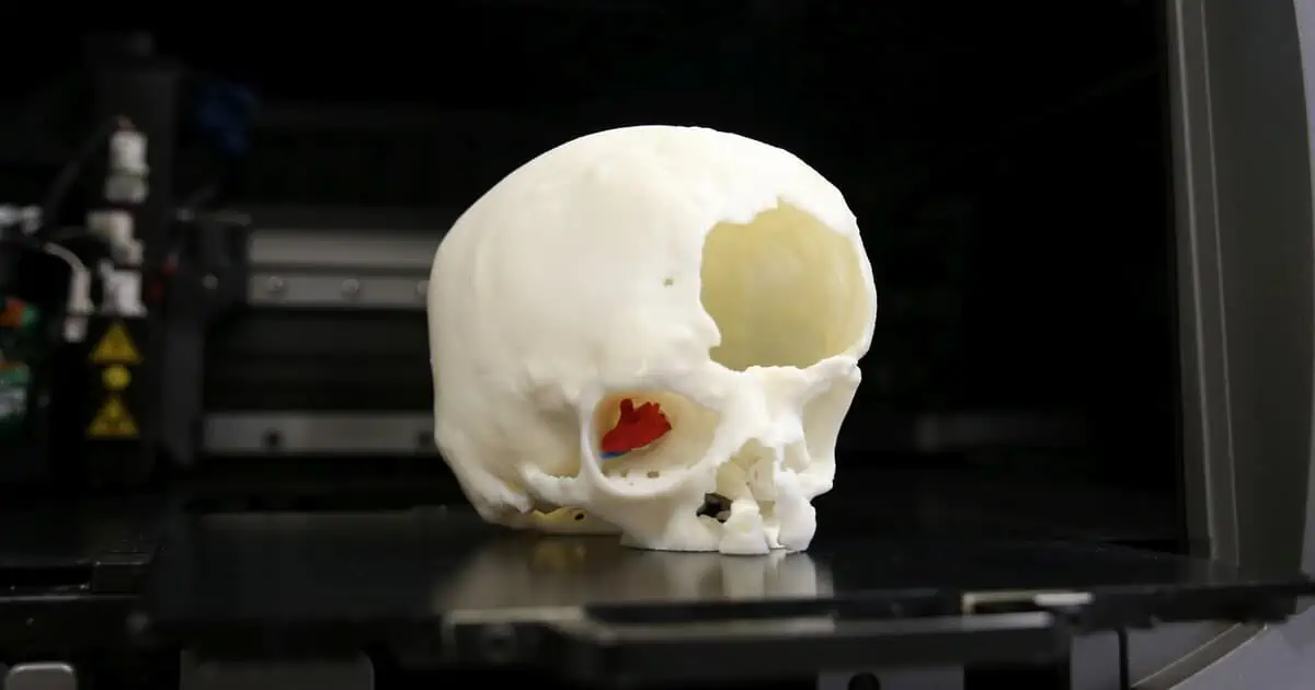 chirurgia grazie all’uso della stampa 3D