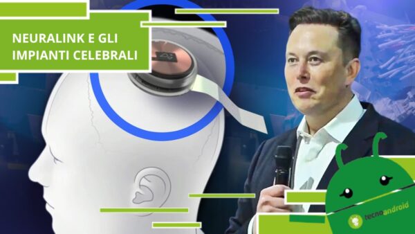 Neuralink, a breve avremo tutti degli impianti artificiali nella testa