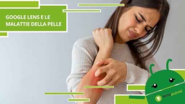 Google Lens, la nuova funzionalità ti permette di scoprire quale malattia della pelle hai