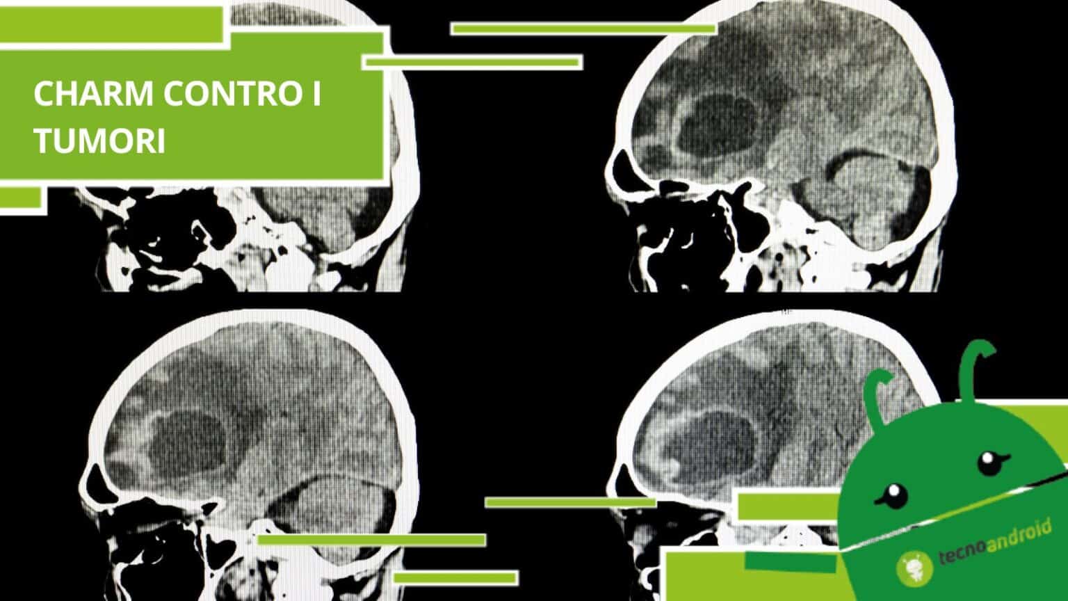 Intelligenza artificiale, grazie a Charm sarà possibile annientare i tumori in tempo reale