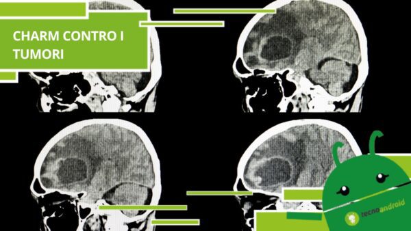 Intelligenza artificiale, grazie a Charm sarà possibile annientare i tumori in tempo reale