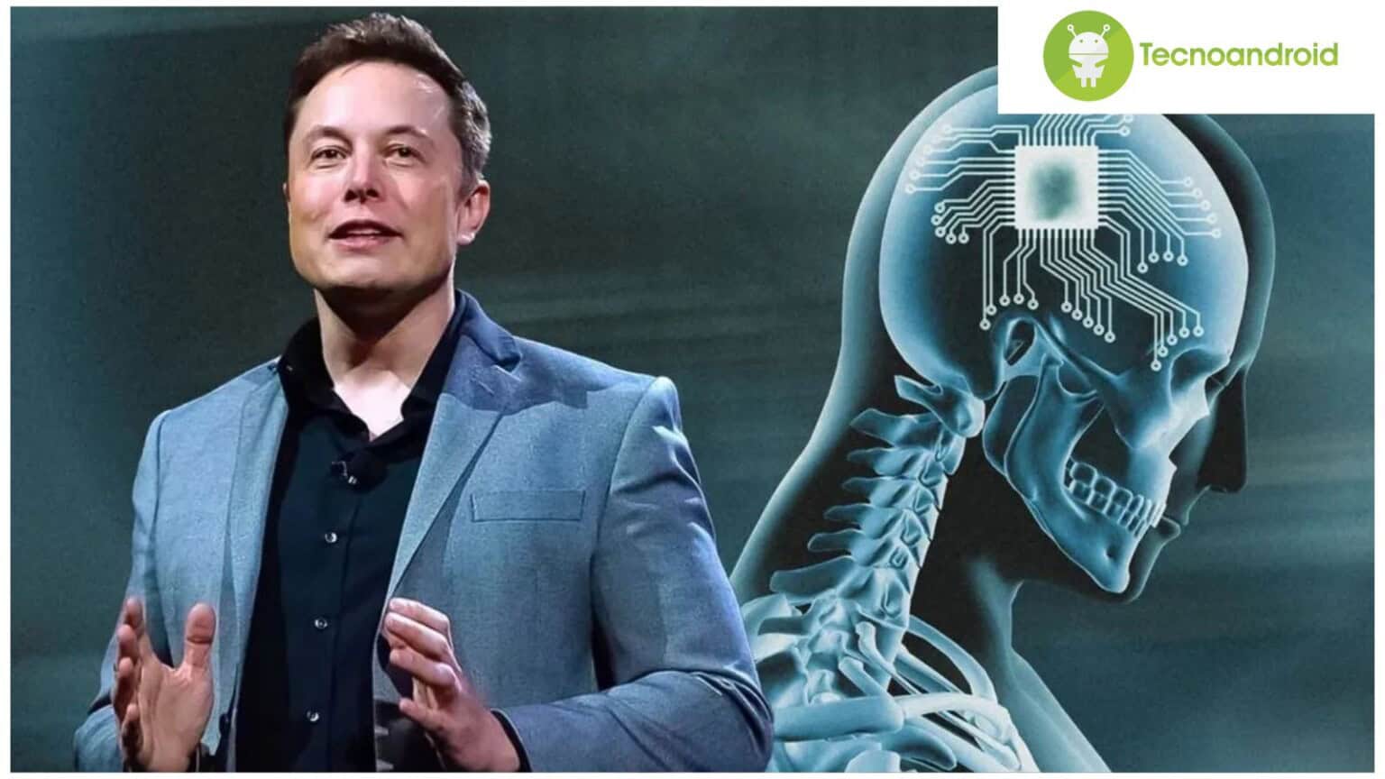 Neuralink