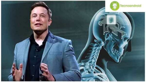 Neuralink