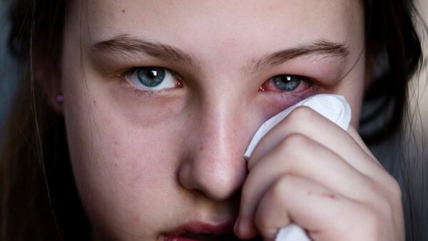 Epidemia di congiuntivite in ASIA pericolosissima, si sta diffondendo