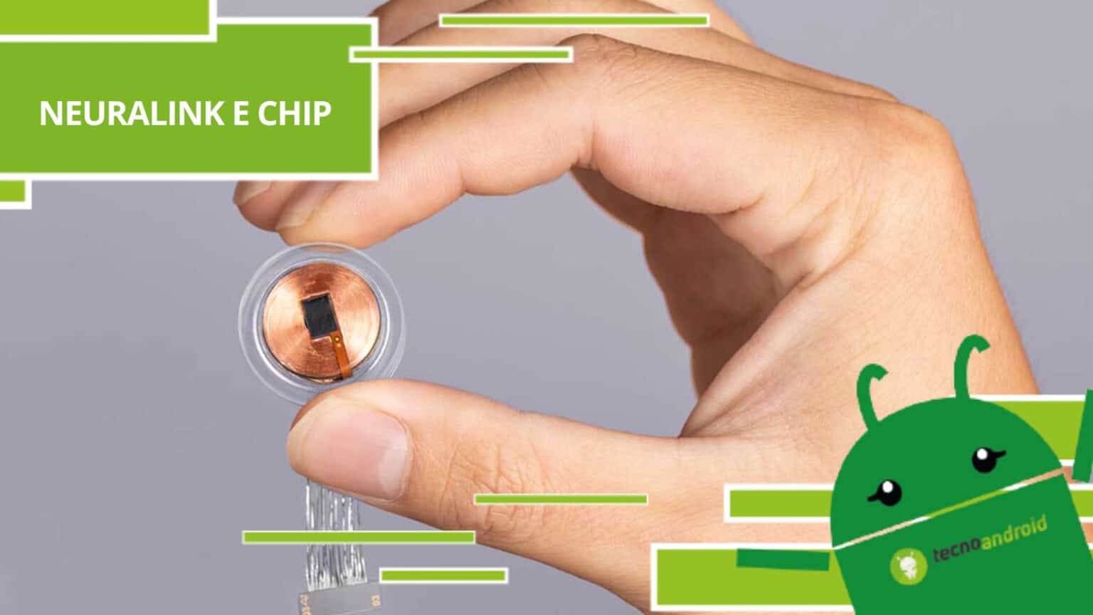 Neuralink, l'azienda è in cerca di volontari per l'installazione di chip celebrali