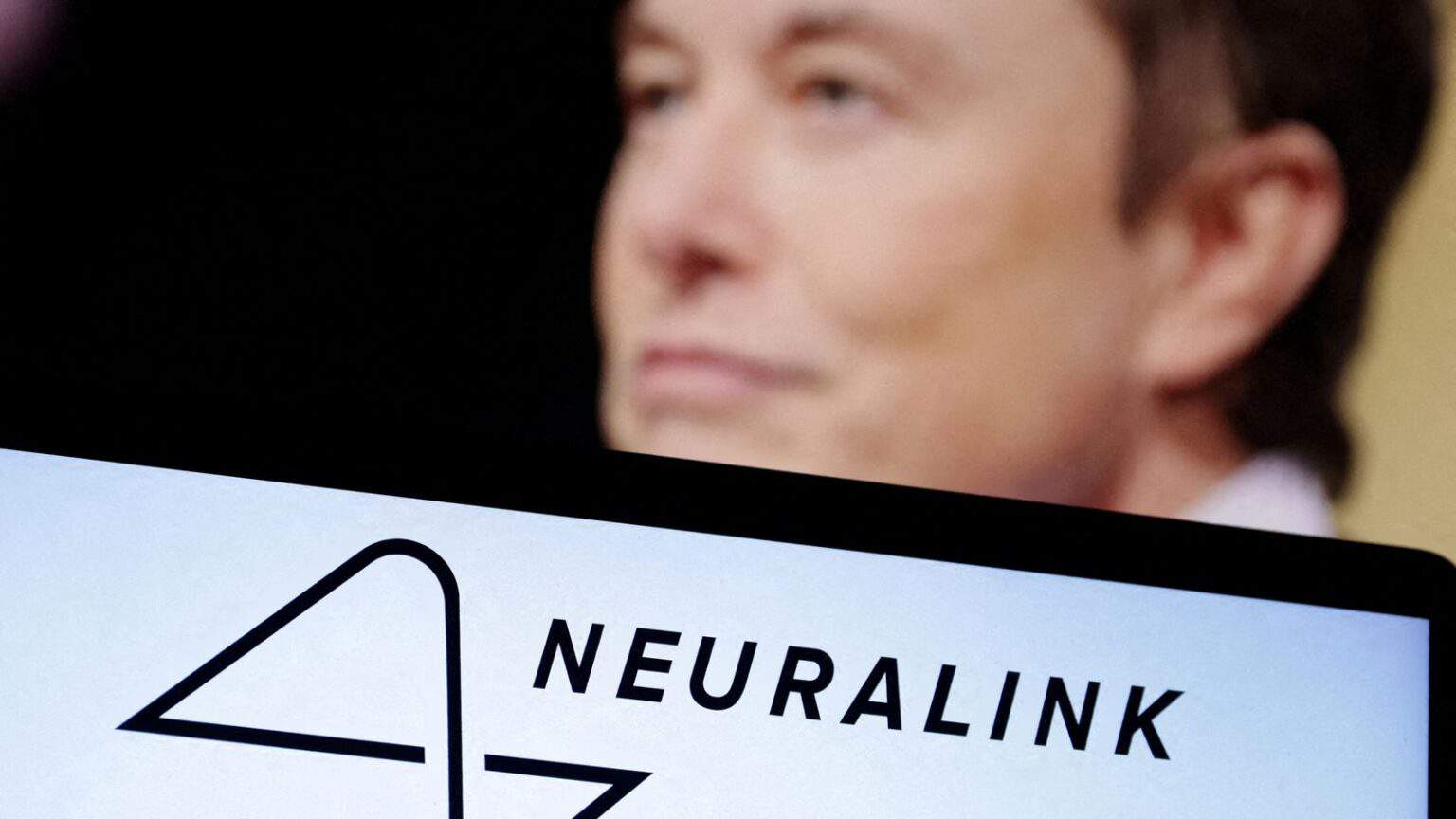 Elon, Musk, Neuralink, impianto