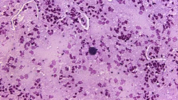 Il lato oscuro della toxoplasmosi: come un parassita può influenzare il nostro comportamento
