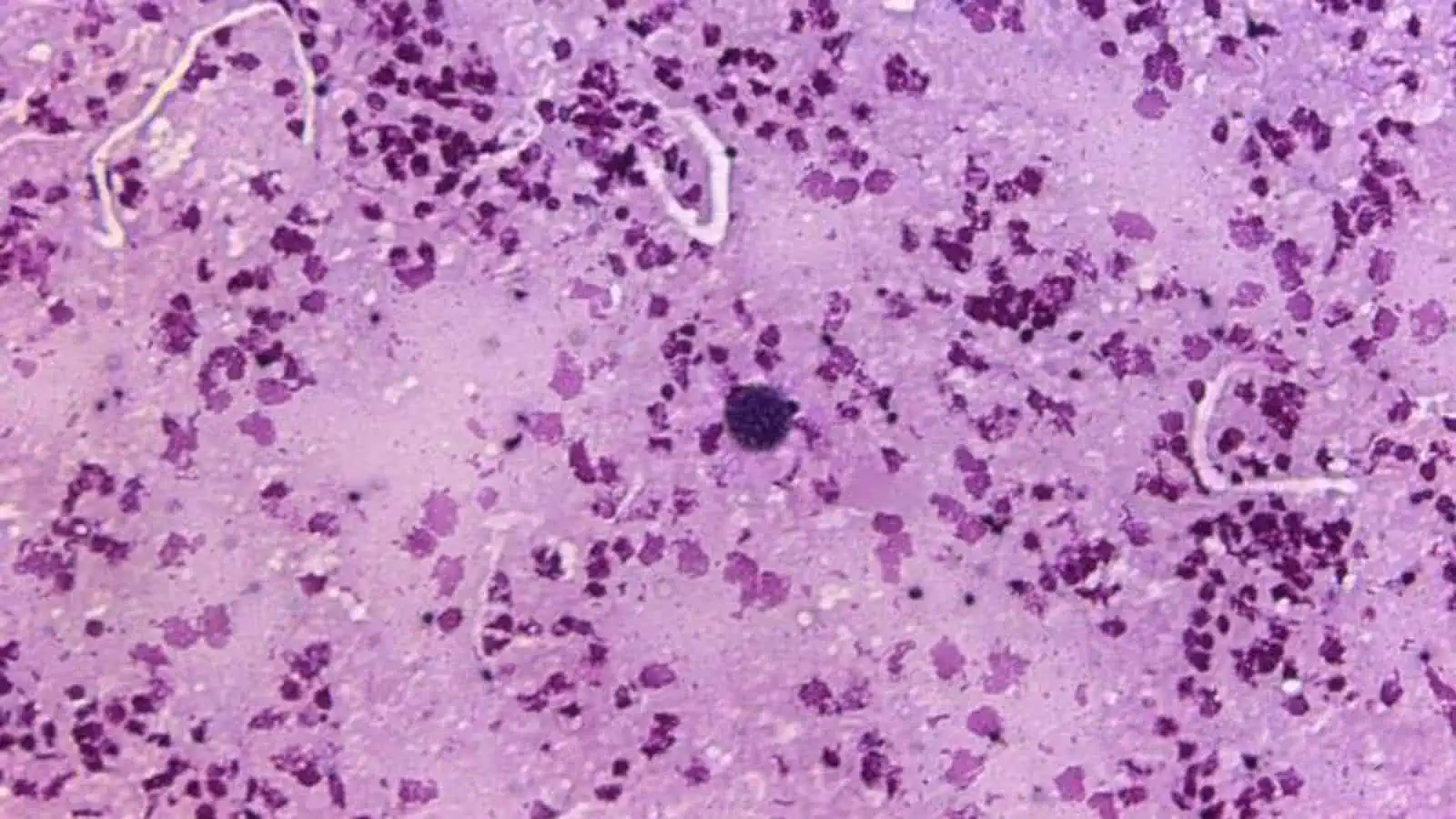 Il lato oscuro della toxoplasmosi: come un parassita può influenzare il nostro comportamento