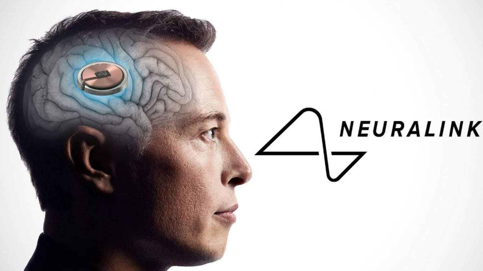 Neuralink: iniziano i test sui volontari umani per testare i dispositivi