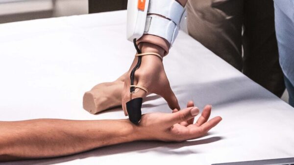 MiniTouch trasforma la percezione tattile nelle protesi, aprendo nuovi orizzonti sensoriali