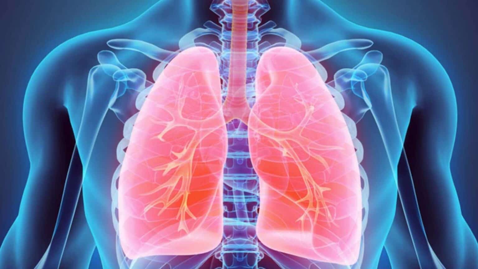 Come l'infezione da Covid-19 può intensificare la risposta immunitaria e peggiorare la polmonite interstiziale