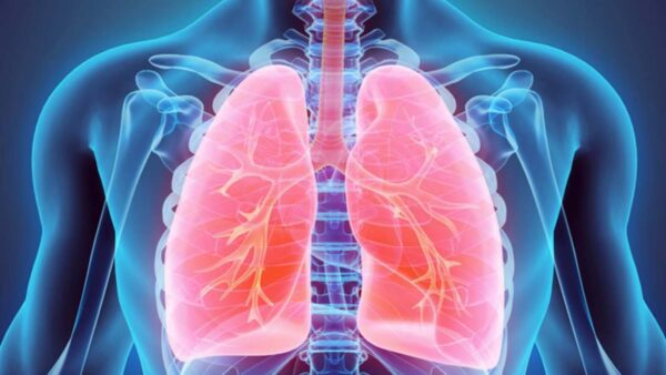 Come l'infezione da Covid-19 può intensificare la risposta immunitaria e peggiorare la polmonite interstiziale
