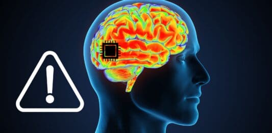 Neuralink: problemi con il primo chip celebrale impiantato
