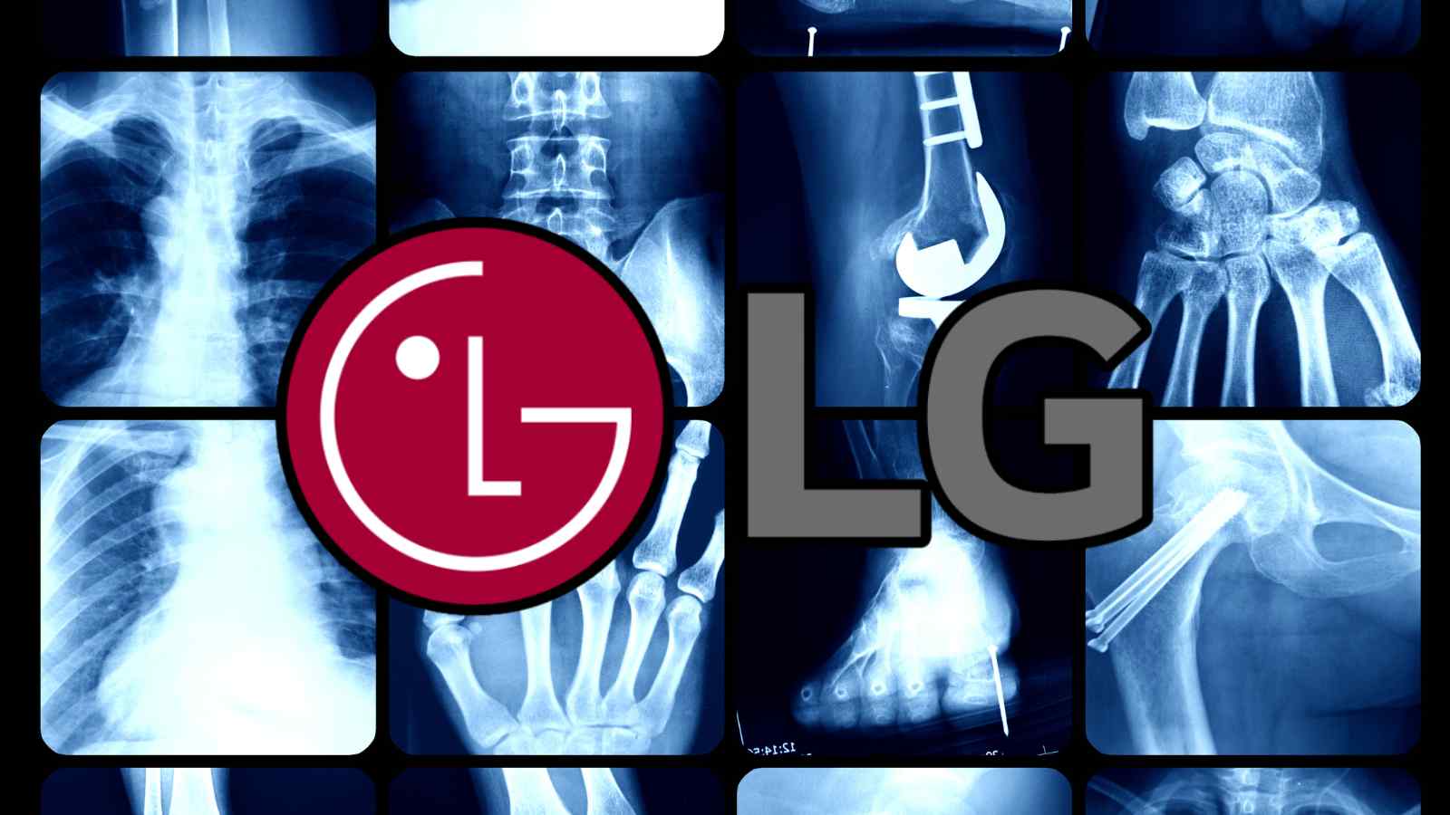 LG e il futuro della radiologia: tecnologie di avanguardia a Milano