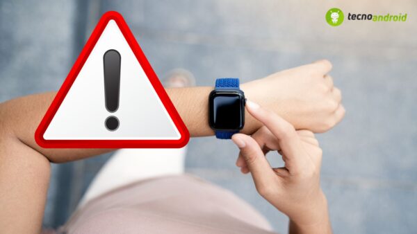 Smartwatch